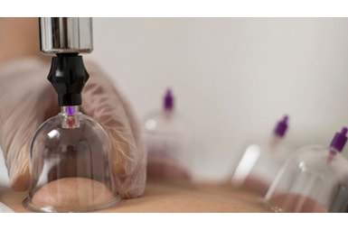 2026 Hacamat Günleri: Sünnete Uygun Hicri/Miladi Hacamat Takvimi