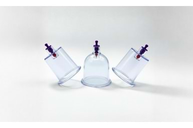 Hacamat Kupası Nedir? Çeşitleri, Kullanımı ve 2025 Fiyatları