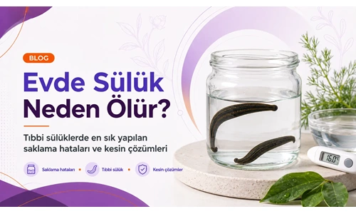 Evde Sülük Neden Ölür?