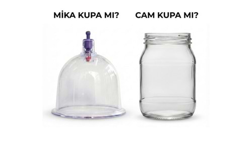 Cam Hacamat Kupası mı, Mika Hacamat Kupası mı?