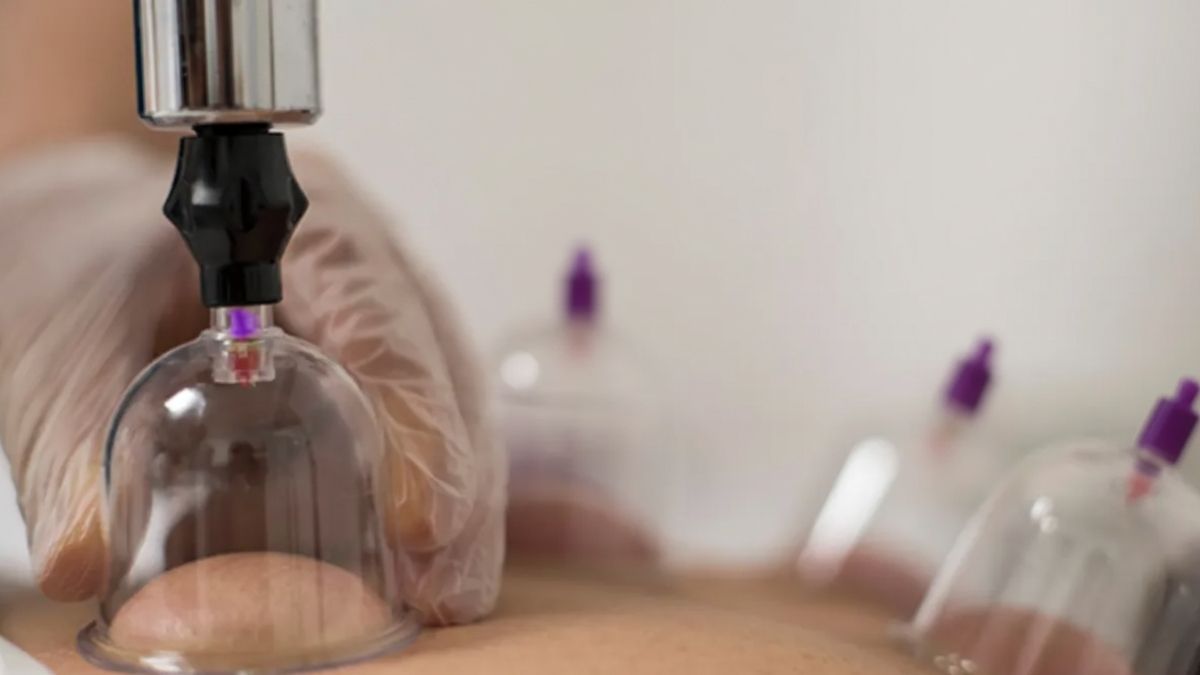 2026 Hacamat Günleri: Sünnete Uygun Hicri/Miladi Hacamat Takvimi