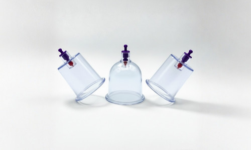 Hacamat Kupası Nedir? Çeşitleri, Kullanımı ve 2025 Fiyatları