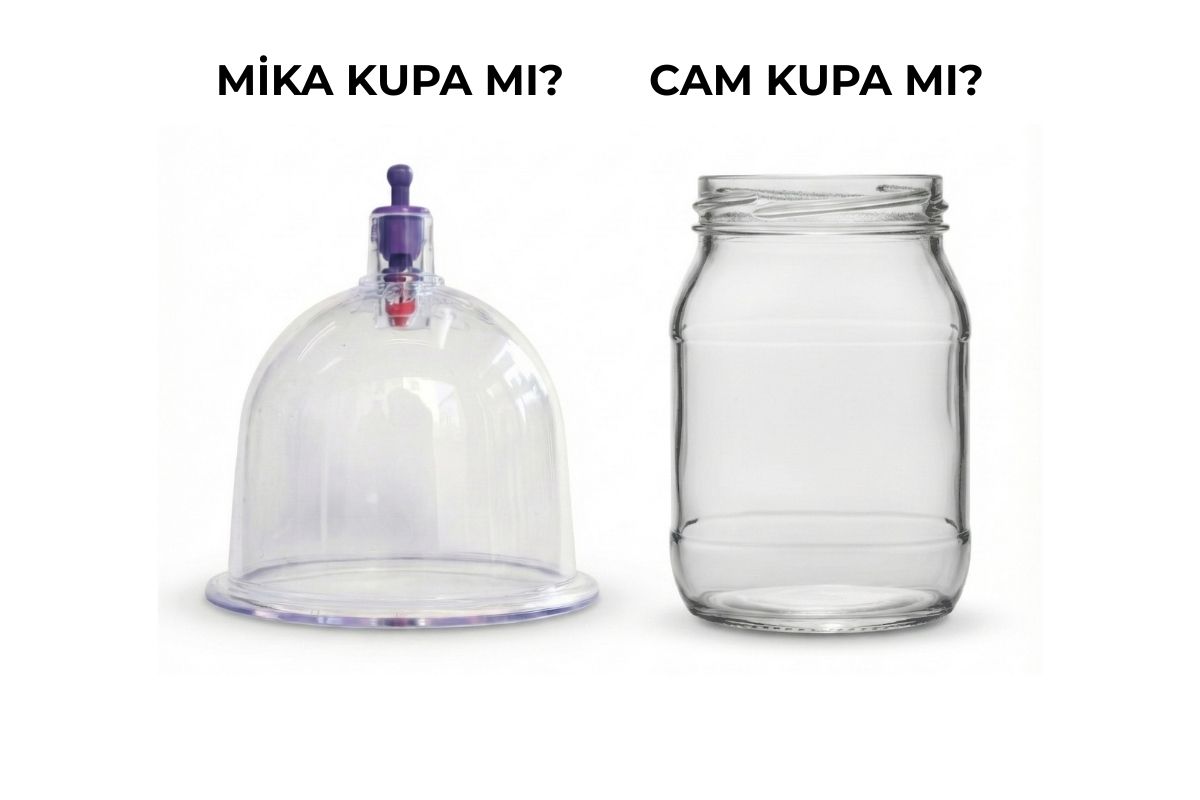 Cam Hacamat Kupası mı, Mika Hacamat Kupası mı?