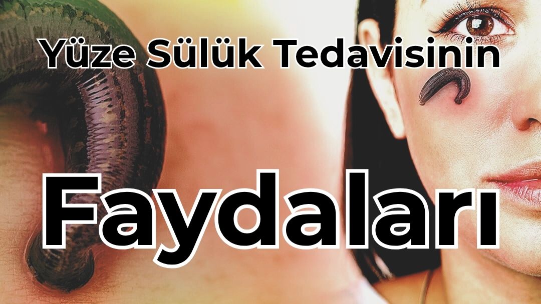 Yüze Sülük Yaptırmanın Faydaları: Doğal Botoks Etkisi ve Cilt Yenileme Sırrı